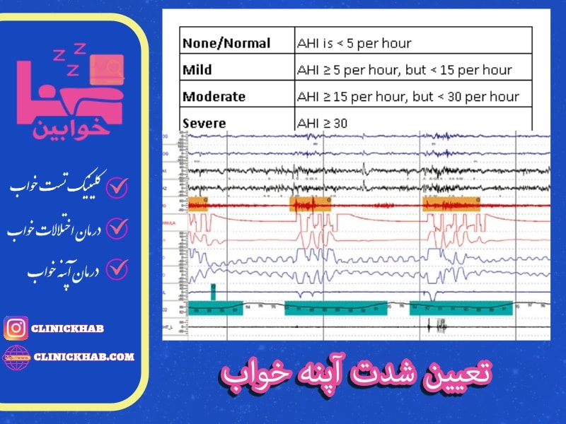 تعیین شدت آپنه خواب