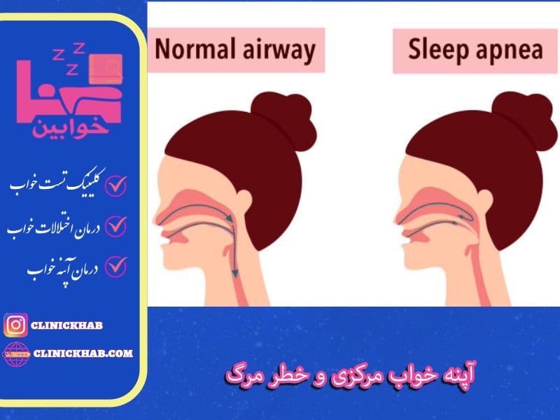 آپنه خواب مرکزی و خطر مرگ