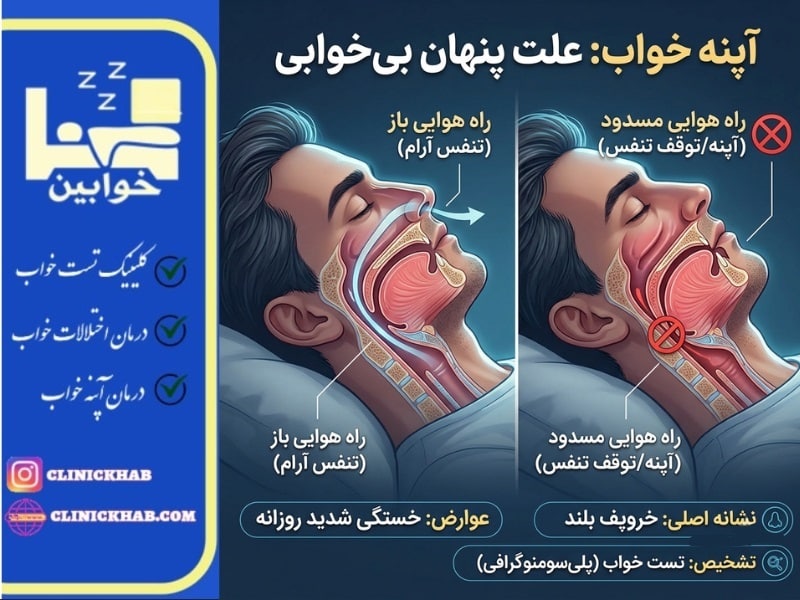بیخوابی نشانه چیست