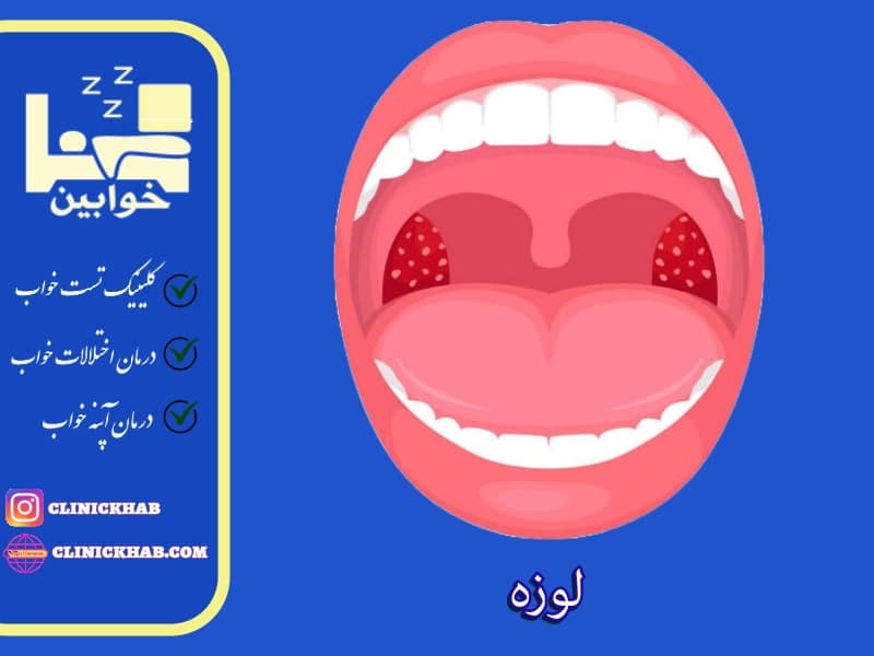 لوزه‌