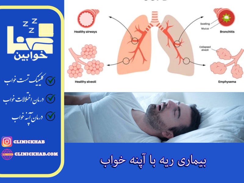 بیماری ریه با آپنه خواب
