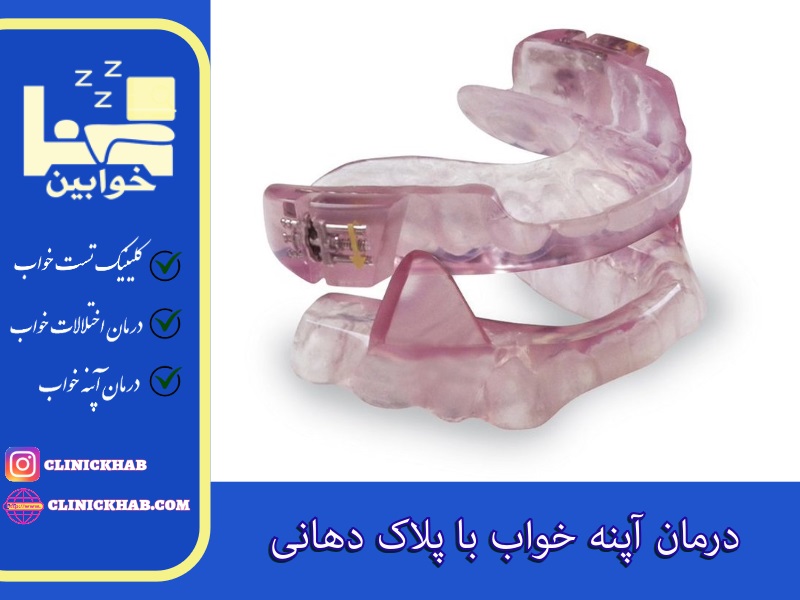 پلاک دهانی برای درمان آپنه خواب