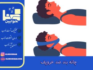 چانه بند ضد خروپف
