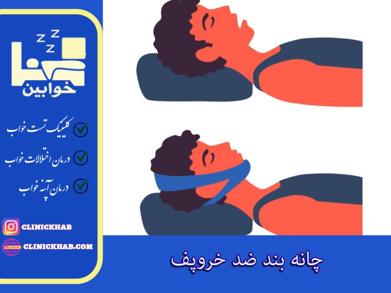 چانه بند ضد خروپف